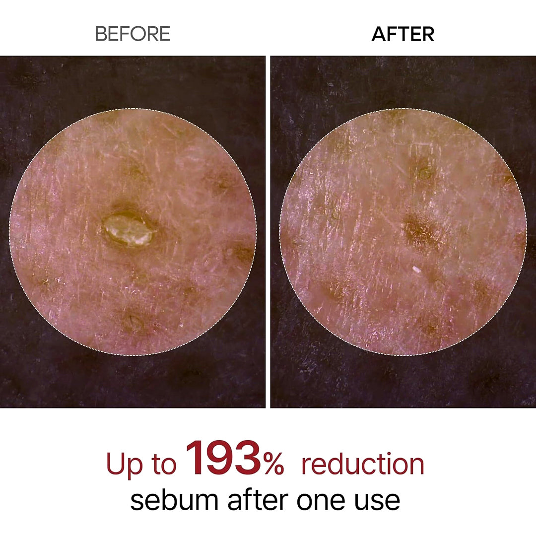 Dr. Melaxin Peel Shot Exfoliant Black Rice Ampoule 80ml
