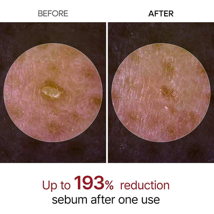 Dr. Melaxin Peel Shot Exfoliant Black Rice Ampoule 80ml