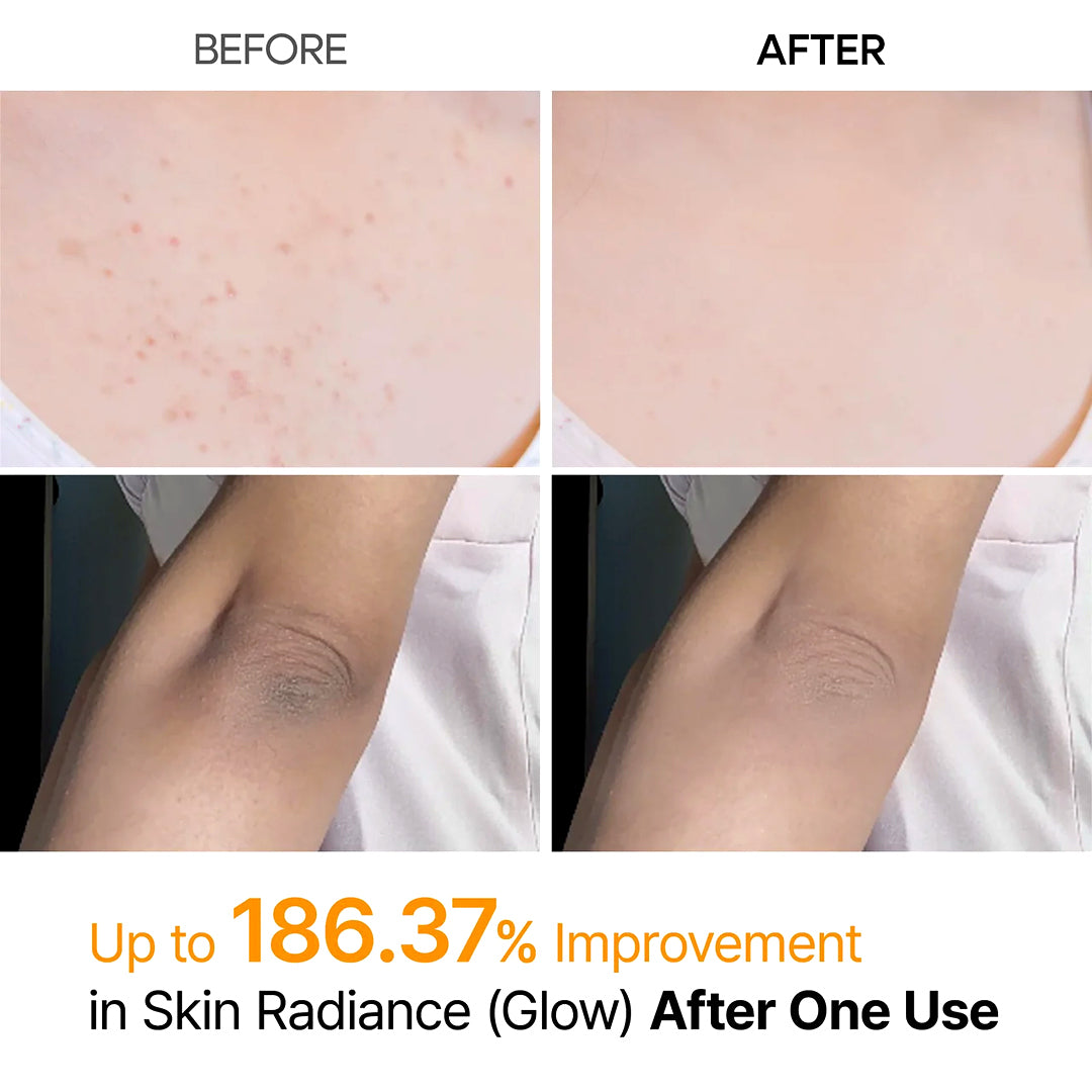 Dr. Melaxin Peel Shot Body Keratin Care Kojic Acid & Turmeric Exfoliating Spray 200ml