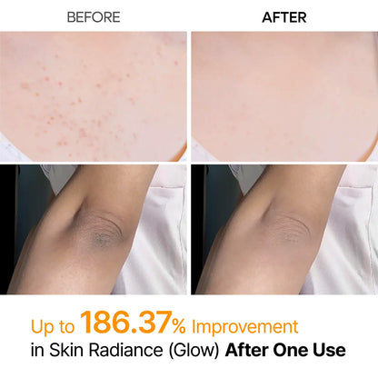 Dr. Melaxin Peel Shot Body Keratin Care Kojic Acid & Turmeric Exfoliating Spray 200ml
