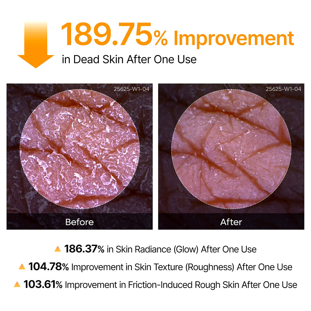 Dr. Melaxin Peel Shot Body Keratin Care Kojic Acid & Turmeric Exfoliating Spray 200ml