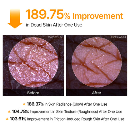 Dr. Melaxin Peel Shot Body Keratin Care Kojic Acid & Turmeric Exfoliating Spray 200ml