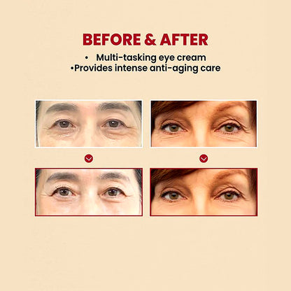 K-Secret Seoul 1988 Eye Cream — Retinal Liposome 4% + Fermented Bean 30ml